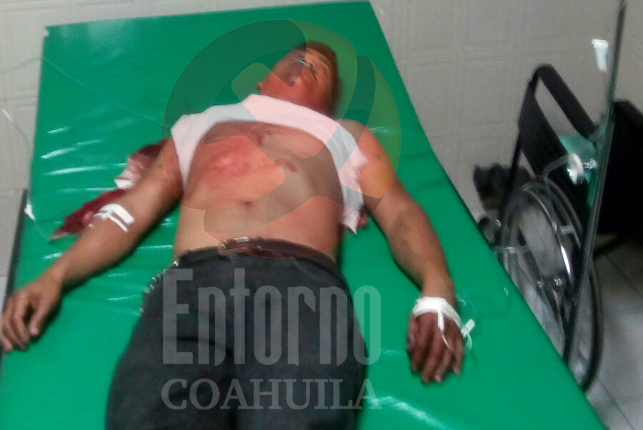 Cazador se pega un tiro en la clavícula en Múzquiz