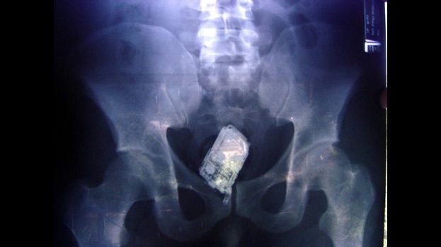 Encuentran 19 celulares en el recto y estómago de tres reos en cárcel de Brasil