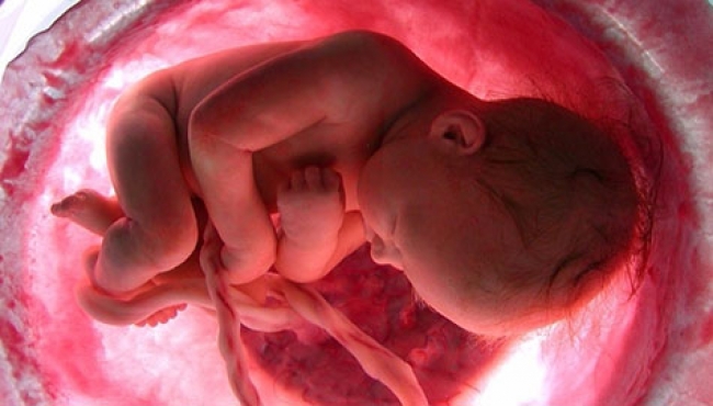 Diabetes gestacional predispone al recién nacido a la obesidad