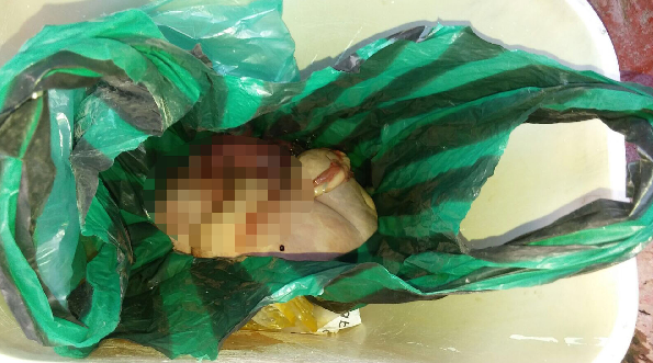 Localizan cadáver de un bebé en bote de basura; madre es detenida en Durango