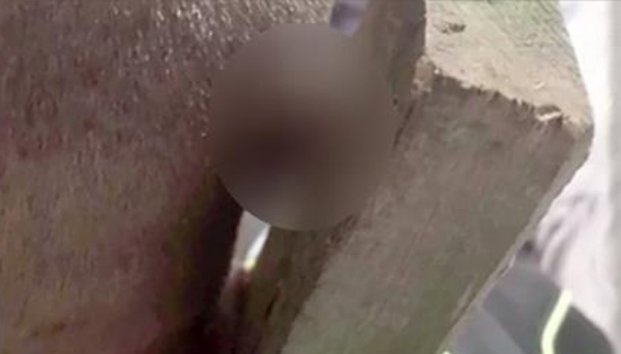 Incrustan clavo en la cabeza a niño de 9 años