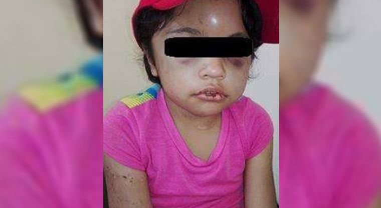 Niña es torturada por sus padres en Sonora