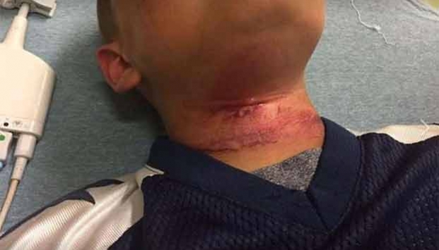 Adolescentes cuelgan a niño de un árbol