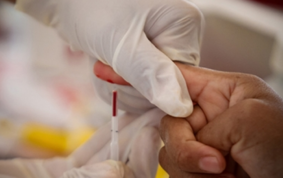 Seguro Social advierte sobre posibles síntomas del VIH-Sida