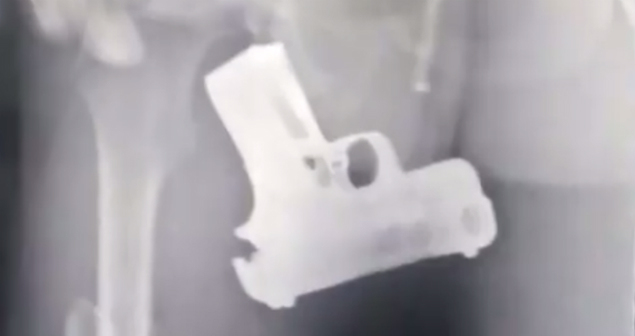 VIDEO: Descubren a ladrón por incomodidad al caminar; escondía pistola en el recto