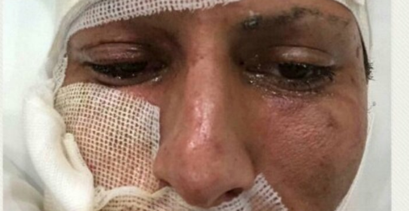 Jürgen Damm manda mensaje