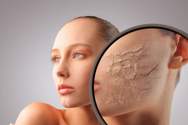 Experto pide cuidar la piel en invierno para prevenir en enfermedades