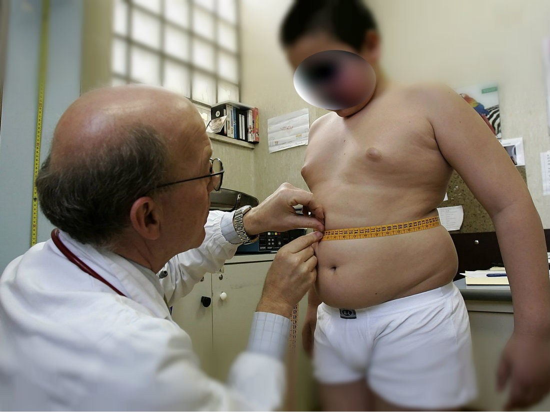 Obesidad infantil reduciría la esperanza de vida de actual generación