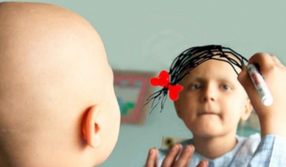 Nueva tecnología evitará la caída de cabello en pacientes con cáncer