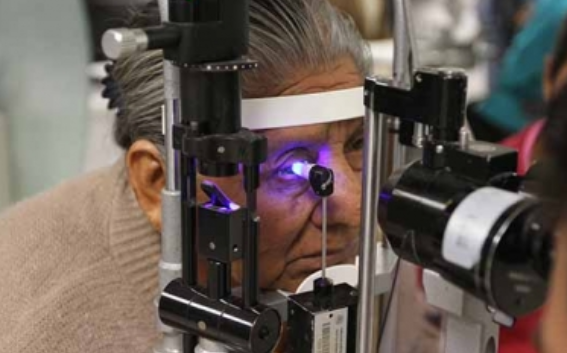 Glaucoma, ladrón silencioso de la vista