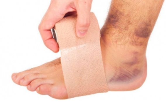 Buscan crear conciencia para la atención de inflamación en extremidades