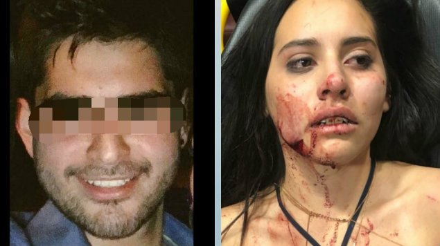 Tras festejo de cumpleaños, joven ebrio golpea brutalmente a su novia