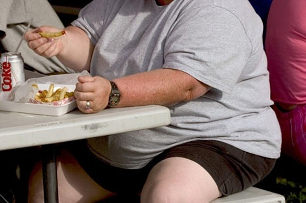 Factores fisiológicos y emocionales llevan a la obesidad mórbida