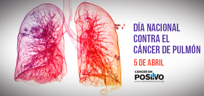 Hoy se celebra el primer Día Nacional Contra el Cáncer de Pulmón en México