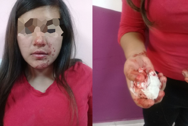 Denuncia a su mamá por golpes en Saltillo