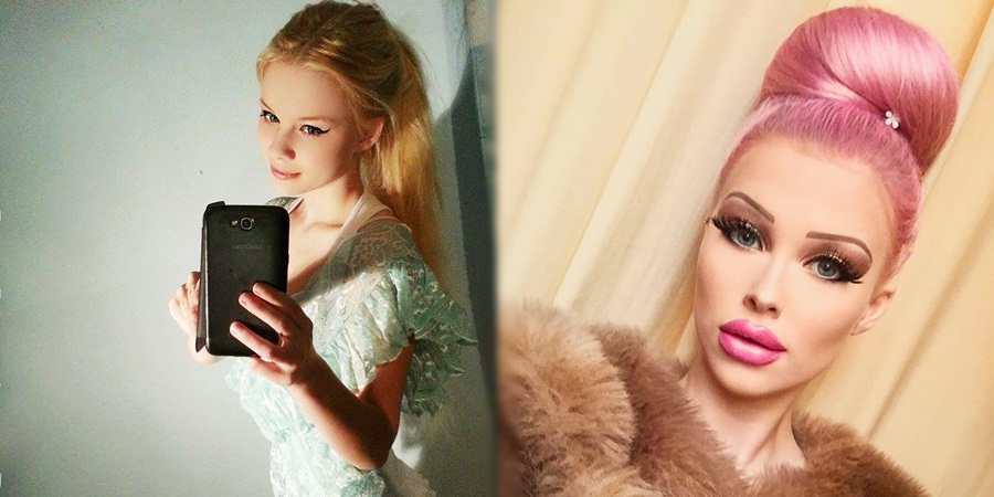 Joven se opera para lucir como Barbie