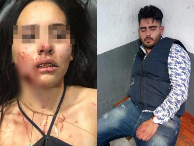 Juez ‘reduce castigo’ a sujeto que atacó y mordió la cara de novia