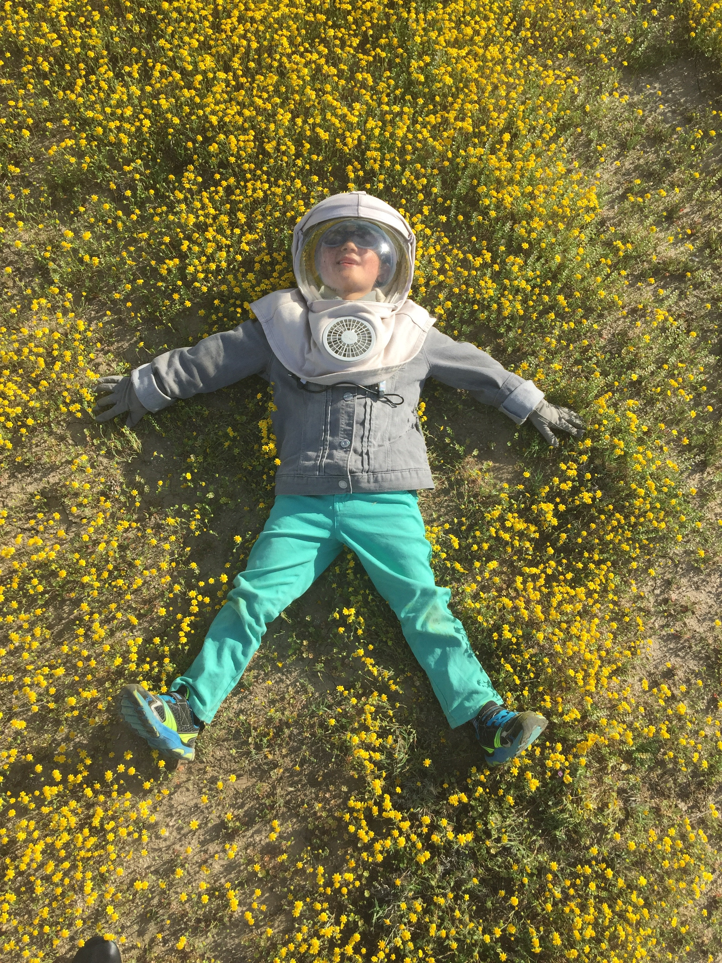 Oliver Kei, el ‘hijo de la luna’: es tan alérgico al sol que debe usar un traje especial todos los días