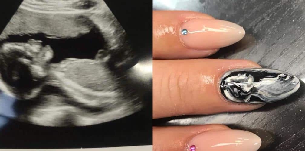 ¿Estás embarazada? Adornar tus uñas con el ultrasonido de tu bebé es la nueva tendencia