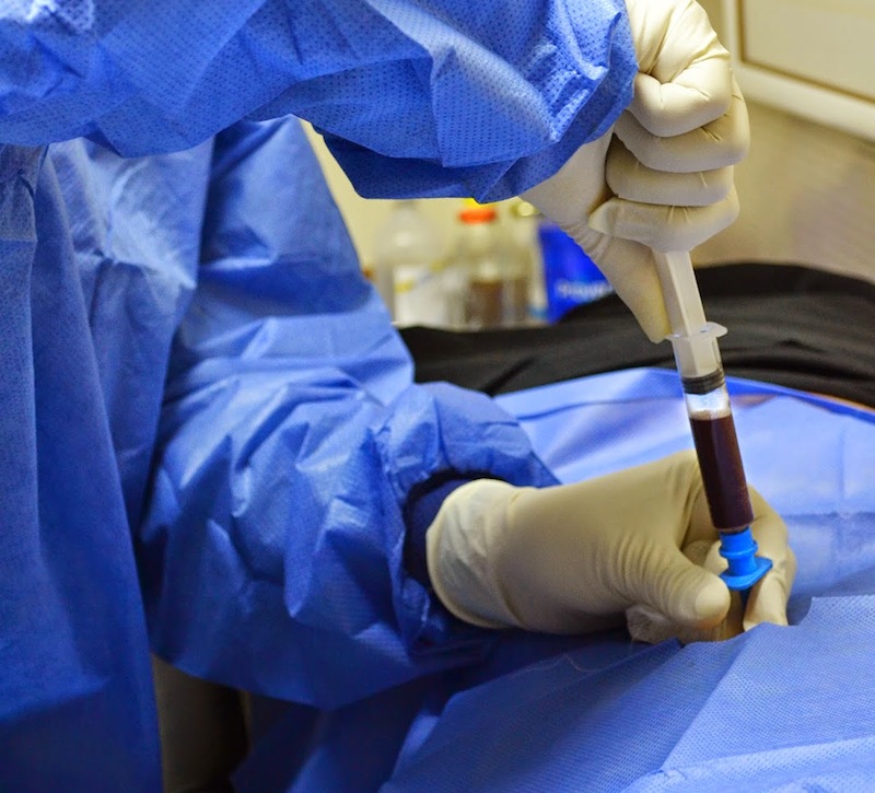 Exitoso primer trasplante de médula ósea infantil en Coahuila