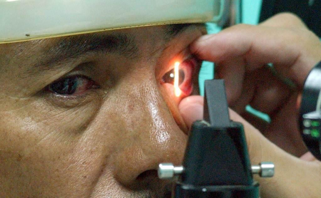 Sólo 20 por ciento de casos de glaucoma presenta síntomas, dice experto