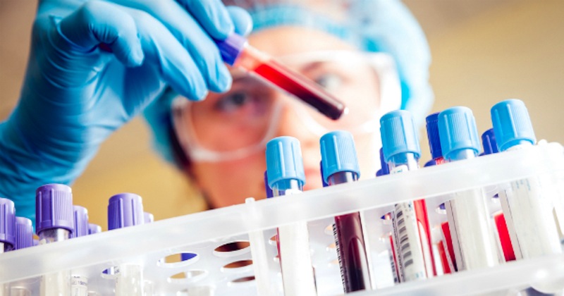 Nuevo método de análisis de sangre ayudaría a detectar daño hepático