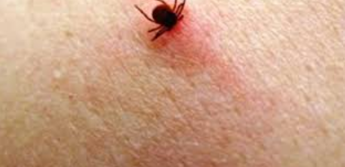 Enfermedad de Lyme es transmitida por una garrapata