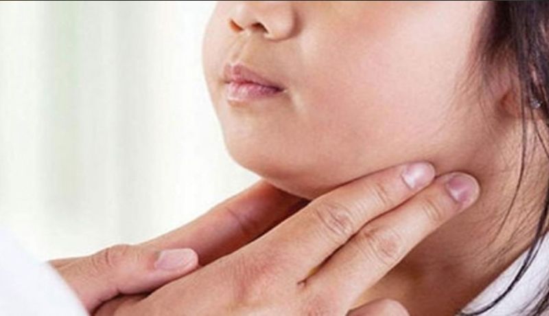 Autoridades descartan una epidemia de paperas en México