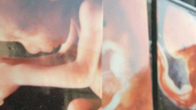 Desestima Suprema Corte de EUA derecho de aborto para indocumentada