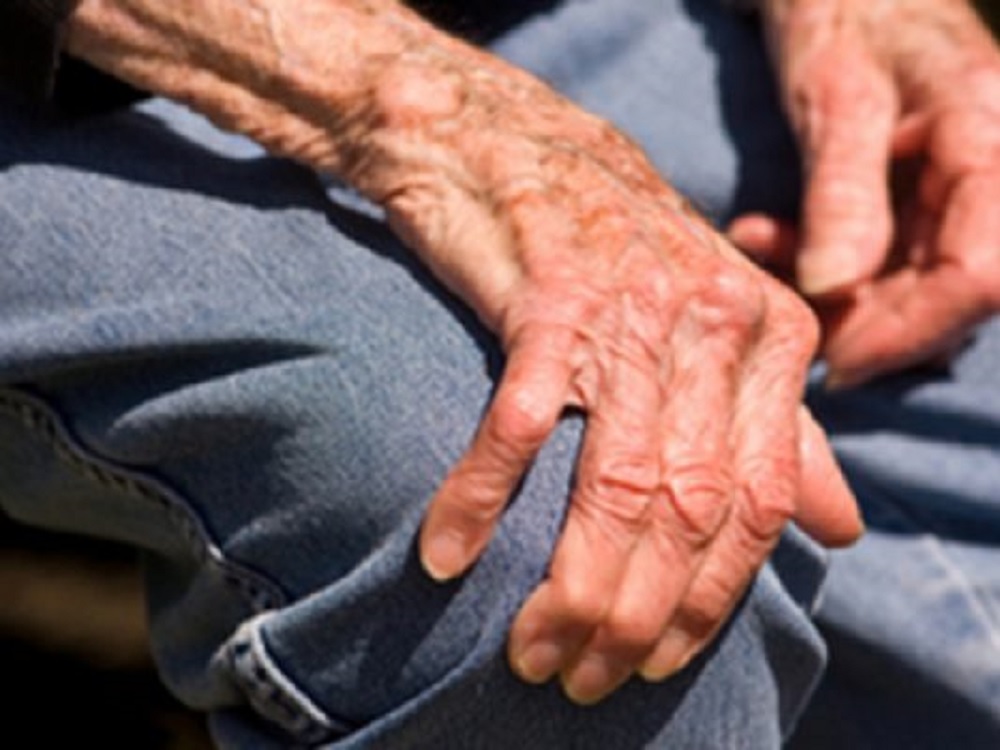 Esclerosis lateral amiotrófica, enfermedad crónica discapacitante