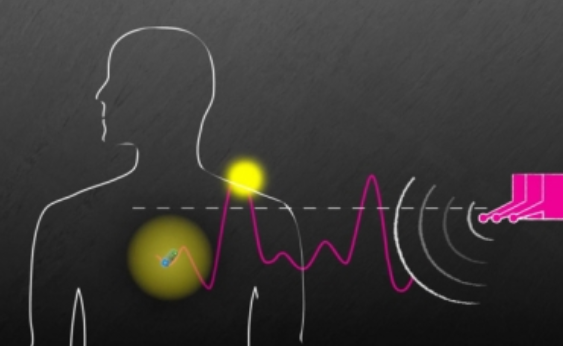 Sistema inalámbrico para alimentar dispositivos dentro del cuerpo