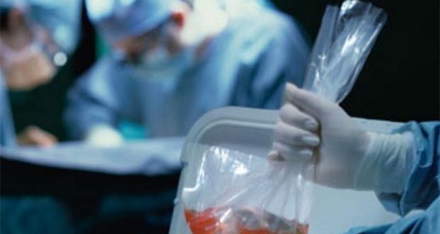 México tiene 22 mil pacientes en lista de espera para recibir un órgano