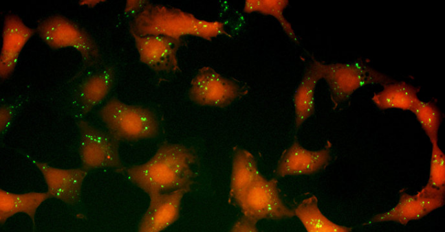 Científicos rusos desarrollan un test exprés para diagnosticar cáncer