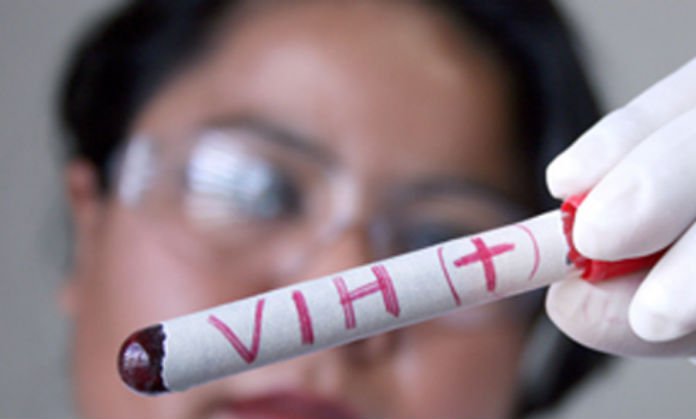 Terapias para VIH-SIDA mejoran calidad de vida de los pacientes