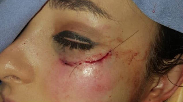 VIDEO:Encaran a actor de Televisa por violación en evento público y él golpea a su víctima