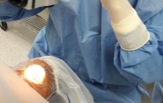 Con cataratas la mitad de los adultos mayores en el mundo