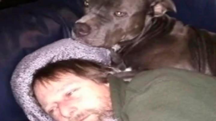 Hombre sufre amputación de extremidades por lamida de perro
