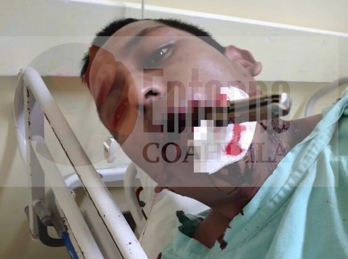 Tío le entierra navaja en la <br>cara; lo trasladan a hospital de Saltillo